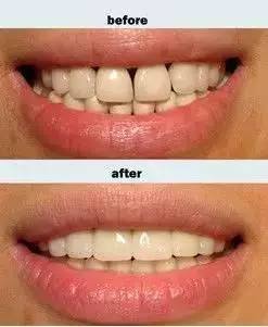https://img.miyanlife.com/mnt/timg/170712/154I91M2-5.jpg