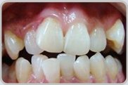 https://img.miyanlife.com/mnt/timg/170712/154IU4I-3.jpg