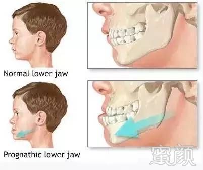 https://img.miyanlife.com/mnt/timg/170712/154Ia0M-7.jpg