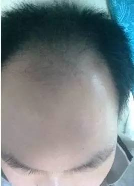 https://img.miyanlife.com/mnt/timg/170712/1916162034-7.jpg