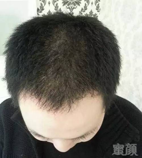 https://img.miyanlife.com/mnt/timg/170712/19161LP9-11.jpg