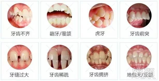 https://img.miyanlife.com/mnt/timg/170712/1G4314T9-2.jpg