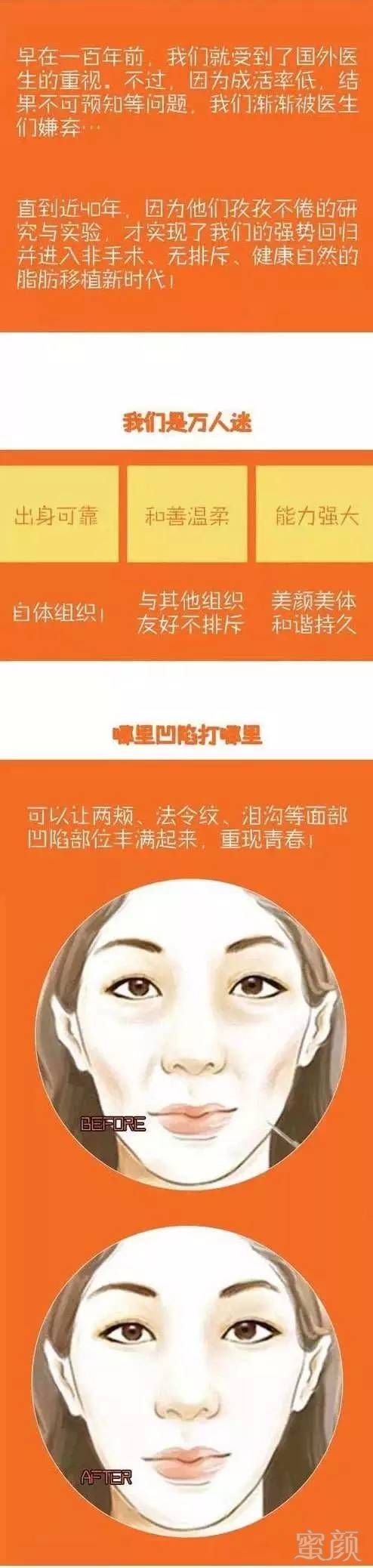 https://img.miyanlife.com/mnt/timg/170713/1046222247-2.jpg