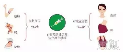 https://img.miyanlife.com/mnt/timg/170713/1046254923-9.jpg