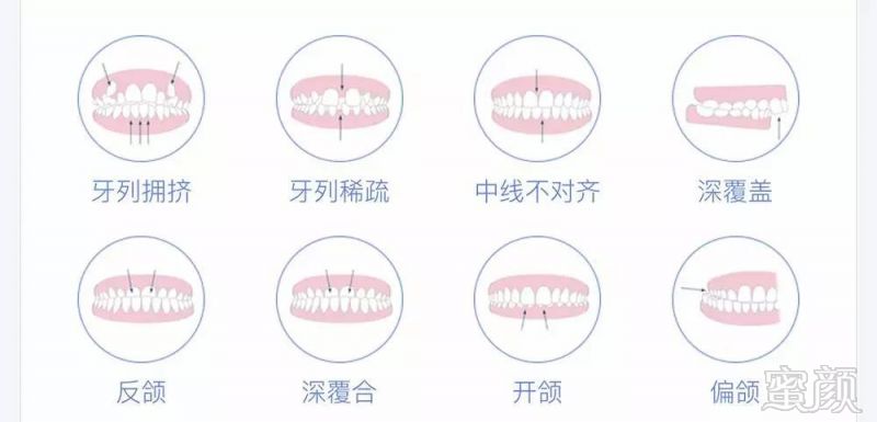 https://img.miyanlife.com/mnt/timg/170713/19342G3V-0.jpg