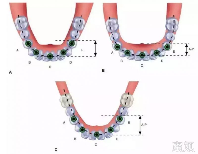 https://img.miyanlife.com/mnt/timg/170713/19342V046-2.jpg