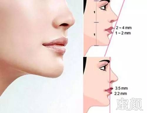 https://img.miyanlife.com/mnt/timg/170713/193430L15-6.jpg