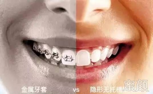 https://img.miyanlife.com/mnt/timg/170713/1934325Z5-11.jpg