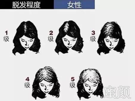 https://img.miyanlife.com/mnt/timg/170713/2213294508-5.jpg