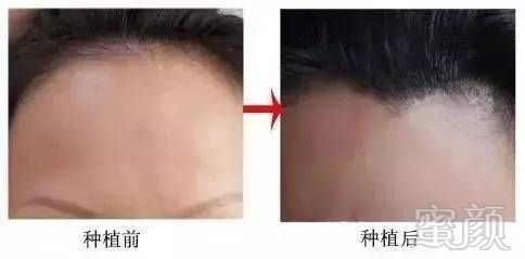 https://img.miyanlife.com/mnt/timg/170713/2213306355-10.jpg