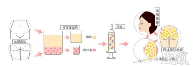 https://img.miyanlife.com/mnt/timg/170713/231P25X6-3.jpg