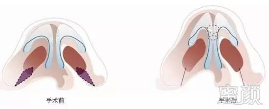https://img.miyanlife.com/mnt/timg/170713/231P944S-9.jpg