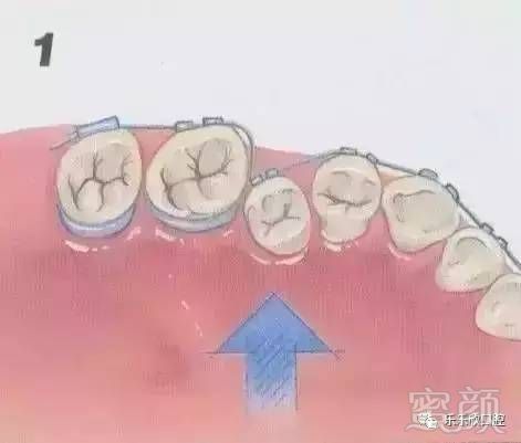https://img.miyanlife.com/mnt/timg/170717/1914552P9-3.jpg