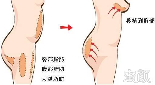 https://img.miyanlife.com/mnt/timg/170717/192Z03L2-6.jpg