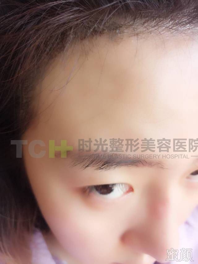 https://img.miyanlife.com/mnt/timg/170717/1R43B328-10.jpg