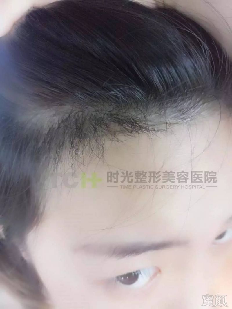 https://img.miyanlife.com/mnt/timg/170717/1R43W1S-14.jpg