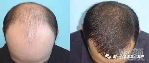 https://img.miyanlife.com/mnt/timg/170717/1R6342514-2.jpg