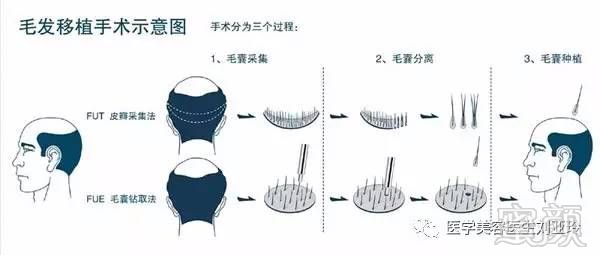 https://img.miyanlife.com/mnt/timg/170717/1R634BY-3.jpg