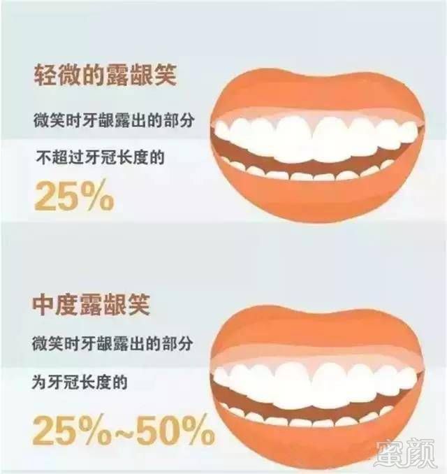 案例图片