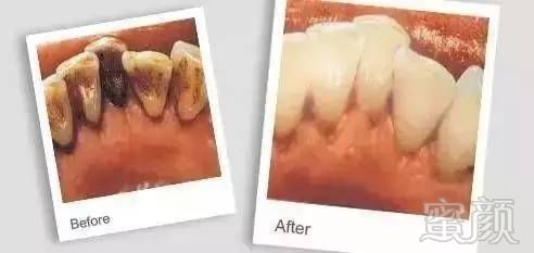 https://img.miyanlife.com/mnt/timg/170718/15464625c-2.jpg