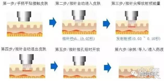 案例图片