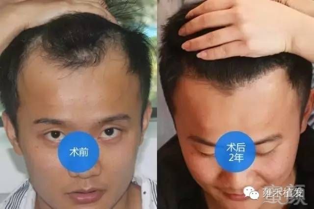 https://img.miyanlife.com/mnt/timg/170719/1629261D9-0.jpg
