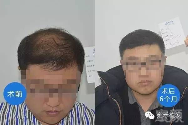 https://img.miyanlife.com/mnt/timg/170719/16292914F-6.jpg
