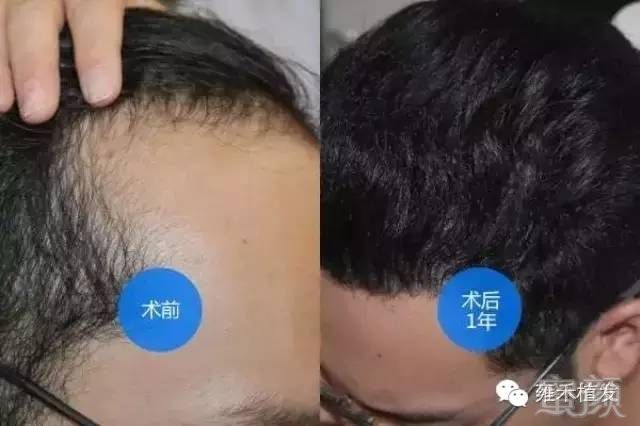 https://img.miyanlife.com/mnt/timg/170719/16292HZ6-1.jpg