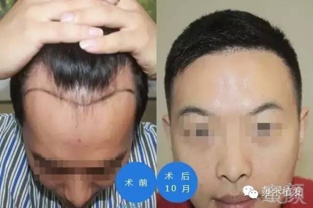 https://img.miyanlife.com/mnt/timg/170719/16292Q248-4.jpg