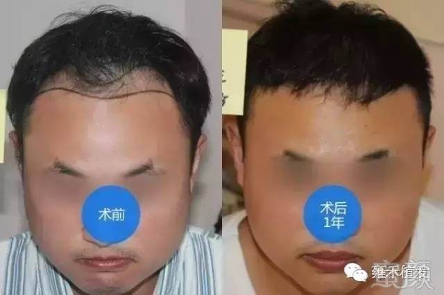 https://img.miyanlife.com/mnt/timg/170719/16292RI6-3.jpg