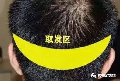 https://img.miyanlife.com/mnt/timg/170719/1631345L8-1.jpg