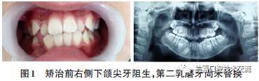 https://img.miyanlife.com/mnt/timg/170719/1H62143M-0.jpg