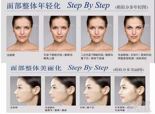 https://img.miyanlife.com/mnt/timg/170721/1K451N41-4.jpg