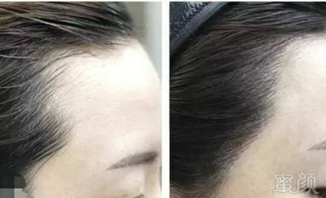 https://img.miyanlife.com/mnt/timg/170723/20111M113-1.jpg