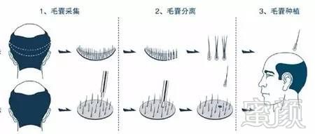 https://img.miyanlife.com/mnt/timg/170723/20250B1R-1.jpg
