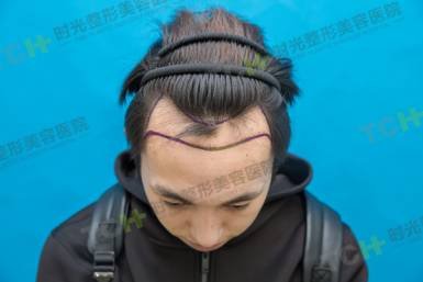 https://img.miyanlife.com/mnt/timg/170723/2143592148-5.jpg