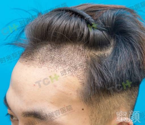 https://img.miyanlife.com/mnt/timg/170723/214401J06-11.jpg