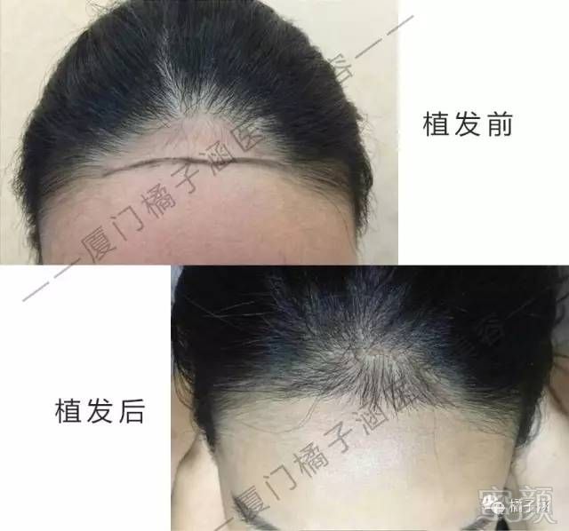https://img.miyanlife.com/mnt/timg/170723/214621NI-7.jpg