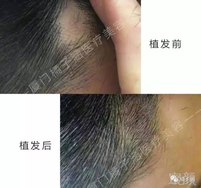 https://img.miyanlife.com/mnt/timg/170723/21462255M-10.jpg
