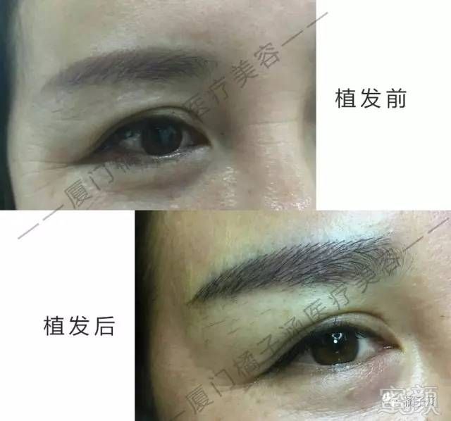 https://img.miyanlife.com/mnt/timg/170723/2146225C3-9.jpg