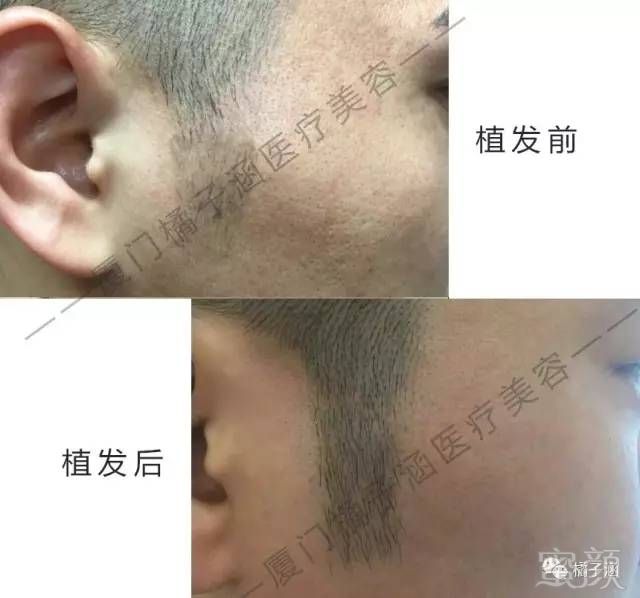 https://img.miyanlife.com/mnt/timg/170723/214622OW-8.jpg