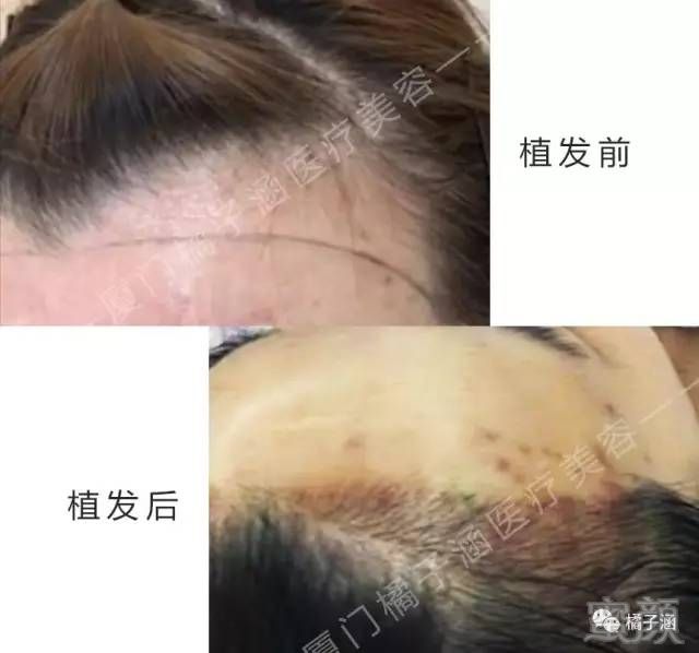 https://img.miyanlife.com/mnt/timg/170723/2146234105-11.jpg
