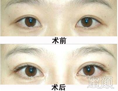 https://img.miyanlife.com/mnt/timg/170723/223A9C41-5.jpg