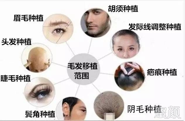 https://img.miyanlife.com/mnt/timg/170723/223AL3T-0.jpg