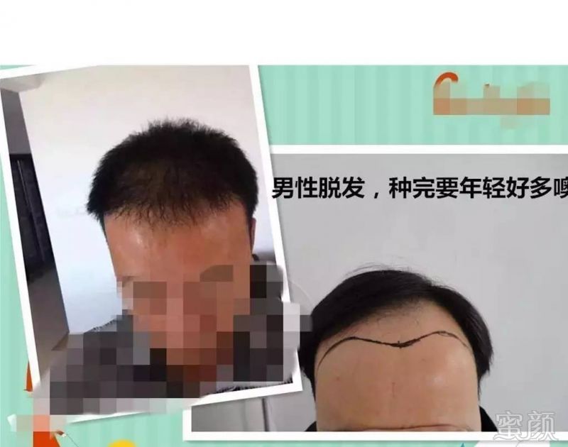https://img.miyanlife.com/mnt/timg/170723/223AR1D-1.jpg
