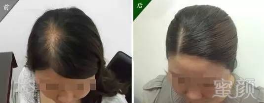https://img.miyanlife.com/mnt/timg/170723/223AU945-2.jpg
