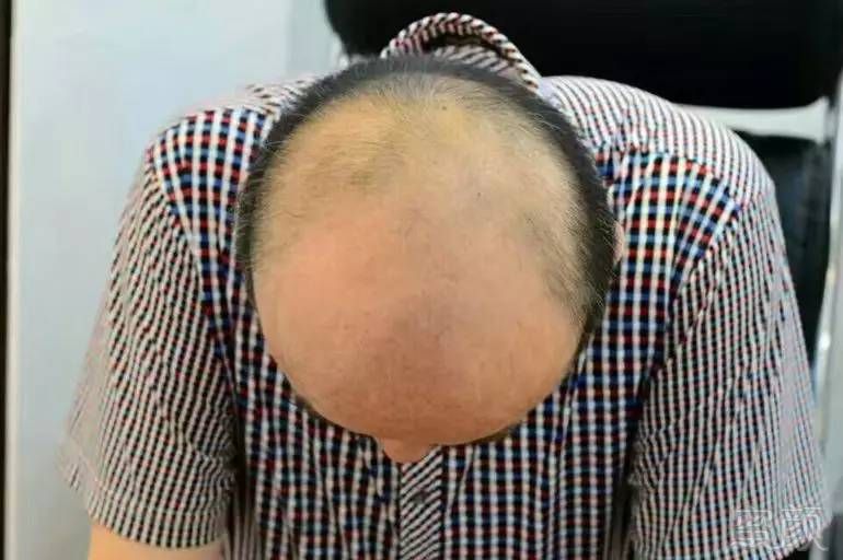 https://img.miyanlife.com/mnt/timg/170724/1546235034-2.jpg