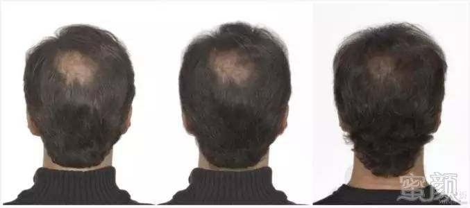 https://img.miyanlife.com/mnt/timg/170724/1546243O2-5.jpg