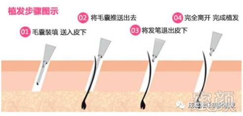 https://img.miyanlife.com/mnt/timg/170724/1P34RI2-1.jpg