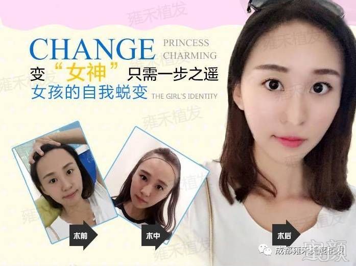 https://img.miyanlife.com/mnt/timg/170724/1P3503391-4.jpg